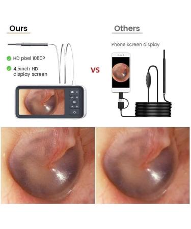 QIYUDS Ear Wax Removal Tool Digital Otoscope with 4.5 Inches Screen 3.9mm Ear Camera with 6 LED Lights 2500 mAh Rechargeable Battery Supports Photo Snap and Video Recording - Buy Online on GoSupps.com