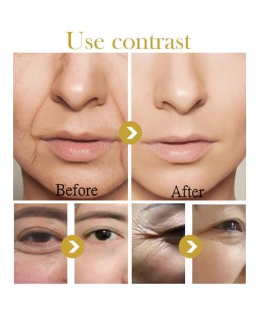 Retinol Face Night Cream - 2.5% Retinol Hyaluronic Acid Vitamin E | Anti-Aging & Fine Line Reducer - 1.7OZ - Buy Online on GoSupps.com