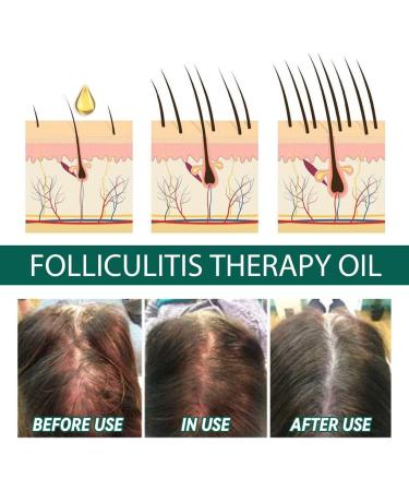 Allayu Adults Dense Hair Growth Essential Oil Natural Ingredient Regrowth Follicle Repair Essence Serum Beauty Supplies - Buy Online on GoSupps.com