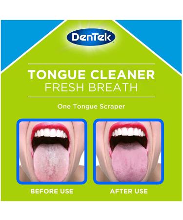Set of 4 Tongue Scrapers | Tongue Brush Cleaner for Bad Breath Relief - Buy Online on GoSupps.com