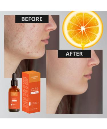 Vitamin C Face Serum - Antioxidant Moisturizer for Women | Fades Acne Scars | Natural Ingredients | 60ml - International Shipping Available - Buy Online on GoSupps.com