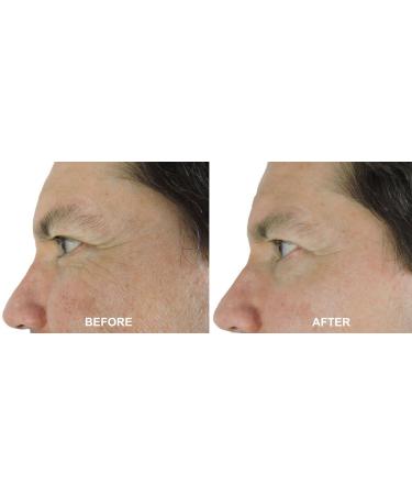 DNA Code -No Needle Alternative-Pure Argireline Peptides Wrinkle Reduce Serum+ Matrixyl 3000+Hyaluronic Acid - Buy Online on GoSupps.com