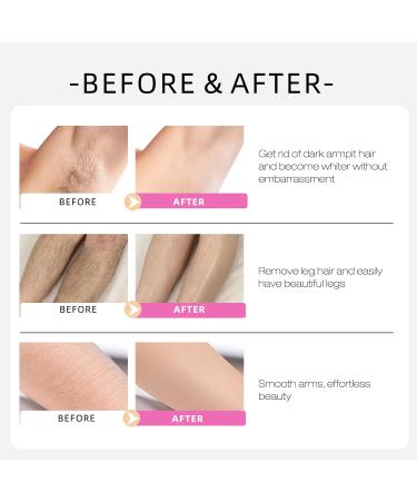 Cyperus Rotundus Oil Softens skin - Cyperus Rotundus Skin Serum Natural Organic Moisturizing Soothing Body Oil Reducing Body Hair for All Skin Types 30ML - Buy Online on GoSupps.com