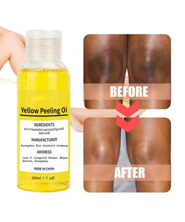 Super Strength Yellow Peeling Oil for Dark Skin - 30/50ml Exfoliating Lightening Treatment - Extra Strength for All Skin Types - Buy Online on GoSupps.com