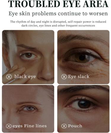 KARLOR Eye Cream Anti-Dark Circles Retinol Eye Cream Oxygen Cream for the Eye Area Anti-Wrinkle Eye Cream for Dark Circles Wrinkles Fine Lines Retinol Eye Cream Anti-Ageing - Buy Online on GoSupps.com