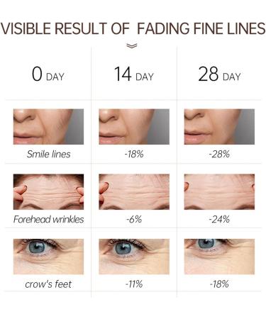 Retinol Face Cream Retinol Moisturiser Cream Retino Cream for Face Reduces Wrinkles Dryness Glowing Skin Anti Wrinkle Anti Aging Retinol Collagen Face Cream 30g - Buy Online on GoSupps.com