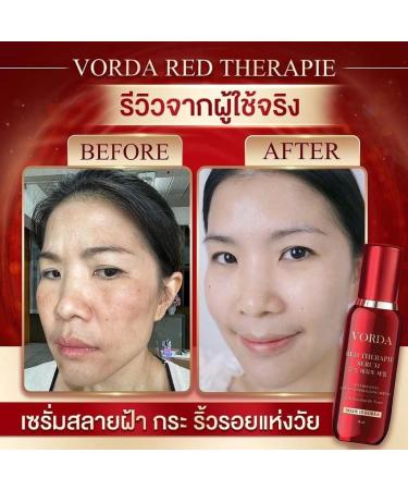 Vorda Red Therapie Serum Facial 30ml - Korean X50 Photoglow for Radiant Skin | International Shipping - Buy Online on GoSupps.com