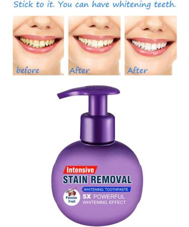 luukiy Baking Soda Toothpaste Whitening Toothpaste Intensive Stain Removal Whitening Toothpaste Stain Removal Whitening Toothpaste Fight Bleeding Gums Teeth Stain Remover - Buy Online on GoSupps.com