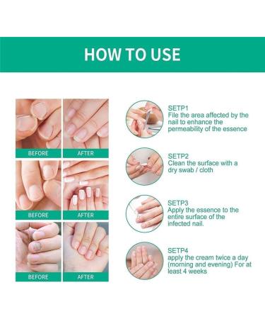 KYOSK Kerassentials Toenail Fungus Treatment Oil Kerassentials for Toenail Fungus Kerasentials Nail Treatment Repair Oil Fix & Renew Damage Nail Broken Cracked & Discolored Nails (5pcs) - Buy Online on GoSupps.com