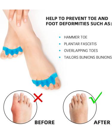 4-Piece Silicone Toe Spreader - Hallux Valgus Correction & Hammer Toe Separator for Pedicure & Toe Alignment - Buy Online on GoSupps.com
