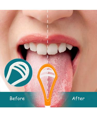 5-Pack BPA-Free Tongue Scrapers | Double-Sided Cleaners for Adults & Kids | Healthy Oral Care & Fresh Breath on the Go - Buy Online on GoSupps.com