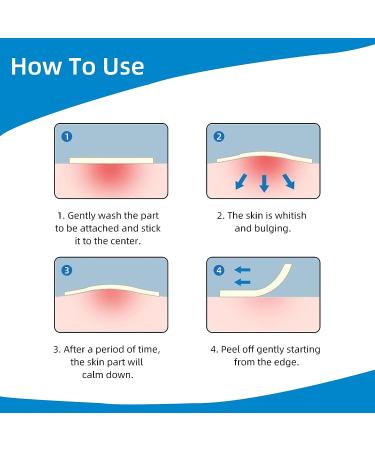 ovand Acne Pimple Patches - Ultra-Thin Hydrocolloid Spot Stickers for Face - 72 Acne Dots - Extra Adhesion Zit Patch - Optimal Healing Treatment - Buy Online on GoSupps.com