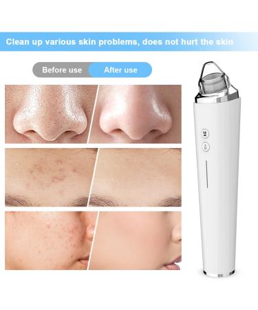 Silkwish Electric Blackhead Remover Pore Vacuum with HD Camera - USB Rechargeable Kit for Women & Men - Buy Online on GoSupps.com