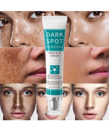 paminify Dark Spot Remover For Face & Body Nicotinamide Freckle Remover Cream Anti-Aging Dark Spot Corrector for Age Spot Sun Spot Moisturizing & Gentle on Skin 1 oz - Buy Online on GoSupps.com