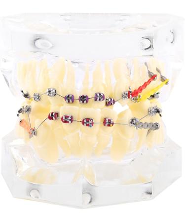 Fydun Dental Orthodontic Tooth Model for Malocclusion Treatment | International Shipping Available - Buy Online on GoSupps.com