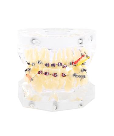 Tooth Model for Orthodontic Treatment - Wire Chain & Brackets | Dental Study Model for Precise Diagnosis & Planning - Buy Online on GoSupps.com