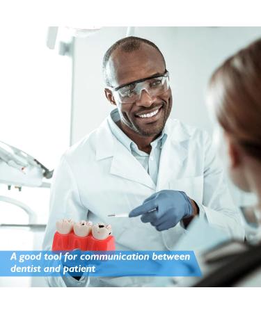 Buy Dental Caries Teeth Model - 4X Removable Tooth Decay & Pathology Display | International Shipping - Buy Online on GoSupps.com