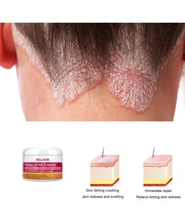 2 Chapped Cream Face Hydrating Moisturizer Moisture Cream for Face Foot Moisturizer Foot Cream Dead Skin Cream Exfoliator Cream Anti Drying Cream Abs Body Lotion Moisturizing - Buy Online on GoSupps.com
