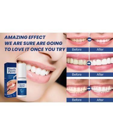 Teeth Whitening Paint Teeth White Paint Tooth Polish Uptight White White Teeth Paint Tooth Paintinstant Whitening Paint Instant White Teeth Paint For Brightening Teeth Remove Stains - Buy Online on GoSupps.com