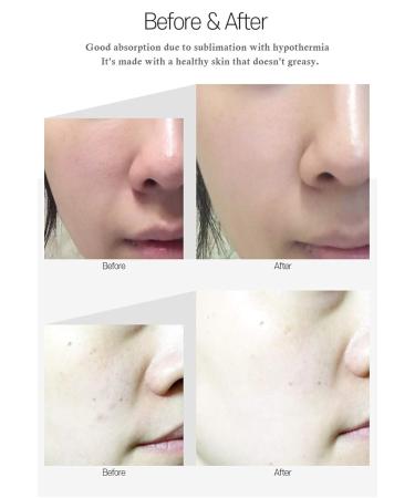 Medi-Peel 5Growth Factor Bor-Tox Peptide Ampoule 30ml | Anti-Aging Serum with Hydrolyzed Collagen & Hyaluronic Acid | Korean Skin Care for Fine Lines Wrinkles & Blemish Care - Buy Online on GoSupps.com