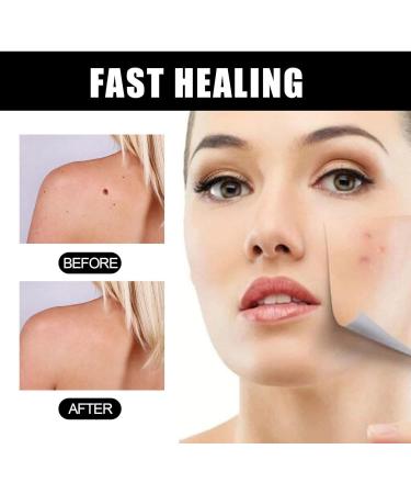 Aobenz Serum | Aobenz Whitening and Freckle Removing Essence | Aobenz Anti-Spot Serum Aobenz Spot Remover Serum Aobenz Dark Spot Correcting Serum Brightening and Removing Freckles (2Pcs) - Buy Online on GoSupps.com