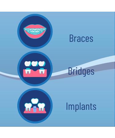 Threader Floss for Braces Bridges & Implants - 30 Count Pack of 3 | Easy & Effective Plaque Remover | On-The-Go Floss - Buy Online on GoSupps.com
