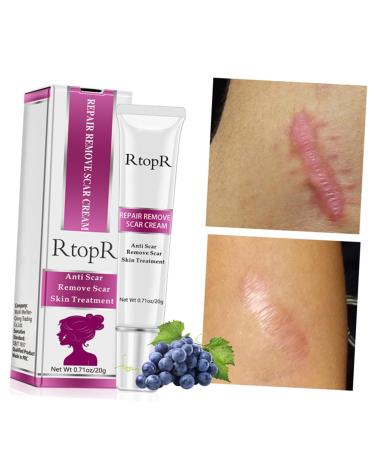 DOITOOL Scar Cream - Face & Body Scar Remover Gel for Wrinkles & Blemishes - Skin Repair & Plastic Surgery Recovery - 1 Count - Buy Online on GoSupps.com