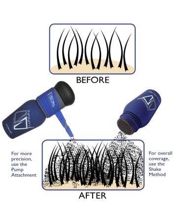 Infinity Hair Fibers - Thicker Fuller Hair for Men & Women | 14g Medium Brown | Conceal Thin Hair Effortlessly - Buy Online on GoSupps.com