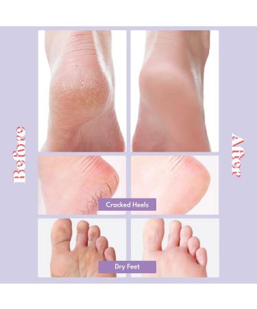 TOI L Extra Silky Foot Mask Glove 5 Pairs - Premium Intensive Moisturizing Foot Care Treatment | Repair & Nourish Dry, Rough Feet (Guerande Salt & Sweet Almond Oil) - Buy Online on GoSupps.com