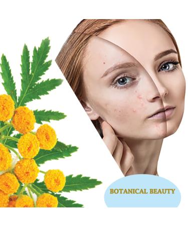 Botanical Beauty Blue Tansy Essential Oil Tanacetum Annuum 100% Pure Therapeutic Grade for Irritated Skin Acne Dried and Damaged Skin Aromatherapy. 0.33 Fl.oz.- 10 ml - Buy Online on GoSupps.com