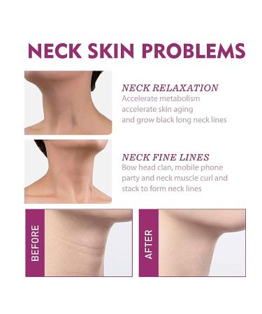 Spain NECKPON Hydrolized Collagen Neck Cream - Neck Firming Anti-Wrinkle Anti-Aging Moisturizer (3PCS) - Buy Online on GoSupps.com