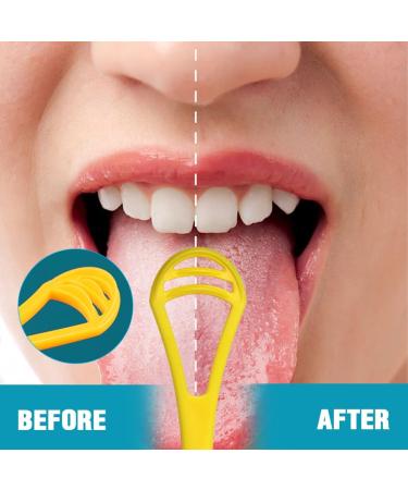 WKRTDY Set of 4 Tongue Cleaners - Gently Remove Bacterial Plaque & Bad Breath | Effective Tongue Brush for Perfect Oral Hygiene - Buy Online on GoSupps.com