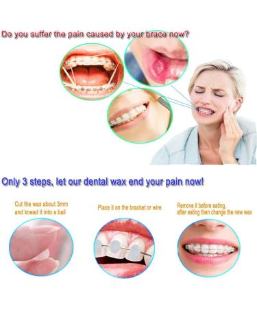 Wenplus 10 Pack Dental Wax for Braces - Orthodontic Wax in 10 Colors & Flavors | Best Oral Care for Braces Wearers - Buy Online on GoSupps.com