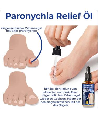 German Toenailcare Removal Paronychia Oil - 2PCS Nail Repair Solution | Anti Paronychia Relief for Damaged Nails - Buy Online on GoSupps.com