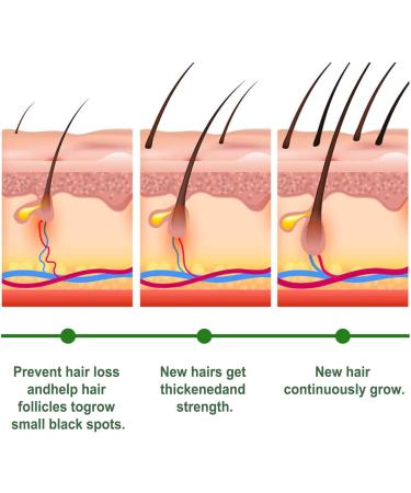 Hair Thickening Oil - Natural Oil for Dry Hair Hair Strengthening Oil Women Beauty Products for Home Business Trip Travel Puchen - Buy Online on GoSupps.com