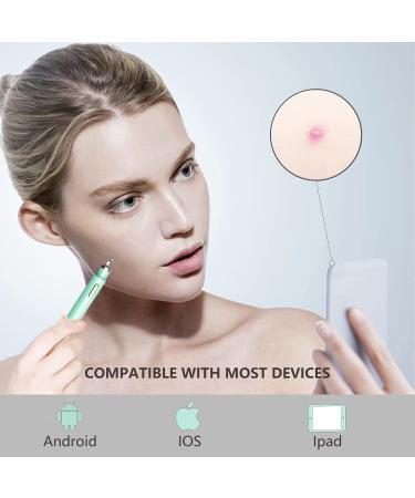 Womfenn Blackhead Remover 2022 - Advanced Pimple Popper with Camera | Acne Comedone Extractor Kit for Skin Care | Pore Clean Tool | 20X Zoom Aquamarine 01 - Buy Online on GoSupps.com