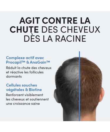 Dr. Balwi S rum anti-chute avec Procapil & AnaGain renforce les racines des cheveux favorise la croissance des cheveux avec biotine et cellules souches sans silicone ni parab ne 5 flacons de 6 ml - Buy Online on GoSupps.com