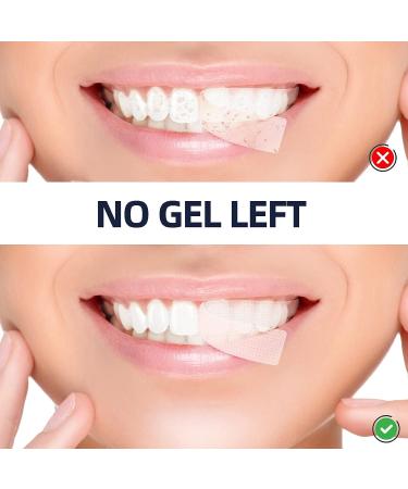 Hauke Teeth Whitening Strips - Non-Slip & Enamel Safe for Sensitive Teeth - Professional Whitener with 28 White Strips - Buy Online on GoSupps.com