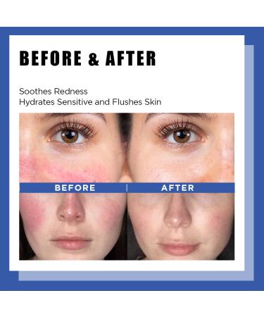 It'S SKIN LI Soothing Cream with Licorice Extract & Guaiazulene - Redness Relief Day & Night Moisturizer 1.85 oz - Buy Online on GoSupps.com