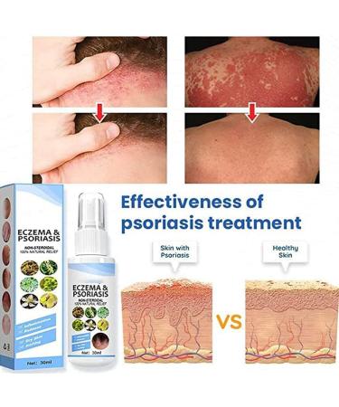 Title: BEESO Melllop Herbal Psoriasis Relief Spray - 5pcs Pack for Itchy Skin Rejuvenation - Buy Online on GoSupps.com