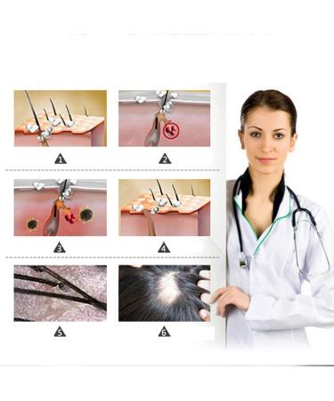 5 Pack Hair Growth Serum with Ginger Biotin for Men and Women - Prevent Hair Loss, Stimulate Regrowth, Strengthen and Lengthen Hair - Natural Formula for Thicker Strands - Buy Online on GoSupps.com