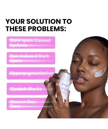 Moona Jolie Dark Spot Eraser Skin Nourishing Lotion - Hydrating Lotion for Face & Body - Improves Appearance of Acne Scars Stretch Marks & Uneven Skin Tone with Vitamin C (250ML) 8.45 Ounce (Pack of 1) - Buy Online on GoSupps.com