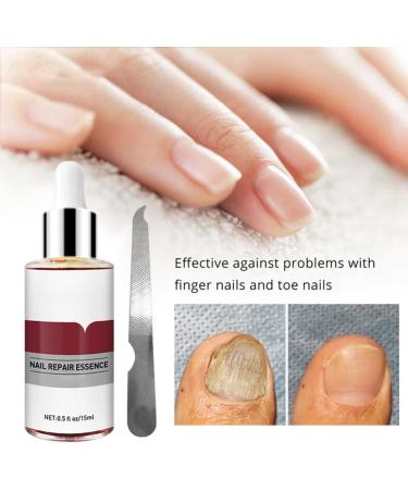OnIUeZky 1 pc nail treatment nail renewal solution toenails and fingernails nail repairs essential oil protects against discoloration brittle and cracked nail 12 ml - Buy Online on GoSupps.com