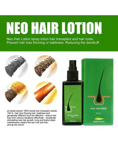 Hair Growth Serum for Men & Women - 120ml Hair Regrowth Lotion Anti Hair Loss Promotes Thicker Stronger Hair & Beard - 100% Natural Herbs - Buy Online on GoSupps.com