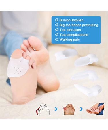 Hallux Valgus Toe Separator by Doact | Comfortable Silicone Gel for Hammer Toes | 3 Pairs - Effective Treatment - Buy Online on GoSupps.com