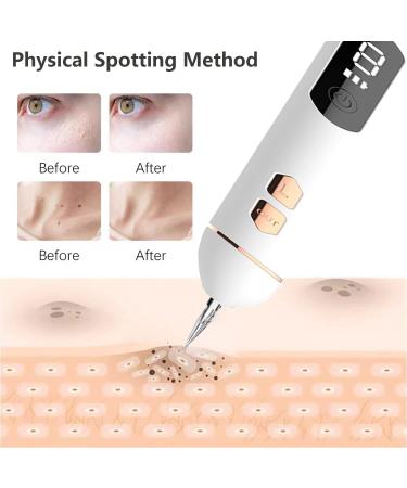 Skin Tag Removal Pen | Portable Mole & Wart Remover Tool with 9 Strength Levels | LED Display & Light | Home Use Spot & Freckle Removal - Buy Online on GoSupps.com