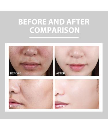 Ultra Facial Cream 150ml Face Moisture Facial Cream Intensive Hydration Daily Moisturiser for Face + Body - Buy Online on GoSupps.com