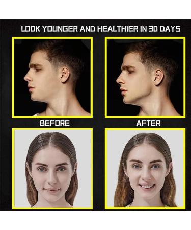 XBY-US Jawline Exerciser - 3 Resistance Levels, Powerful Jaw Trainer for Men & Women, Slims & Tones Face - Buy Online on GoSupps.com