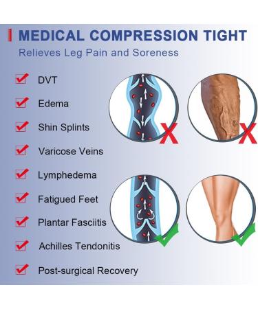 Beister Class 2 Medical Compression Tights - Open Toe Thigh High Pantyhose 20-30 mmHg for Varicose Veins & Edema - Beige XL - Men & Women - Buy Online on GoSupps.com