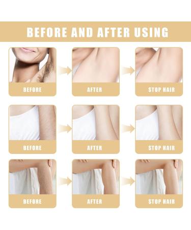 Meanju Hair Growth Inhibitory Serum Natural Hair Remover Hair Removal for Face Armpits Legs and Arms for Long Lasting Smooth Skin and Easy Management of Hair Growth - Buy Online on GoSupps.com